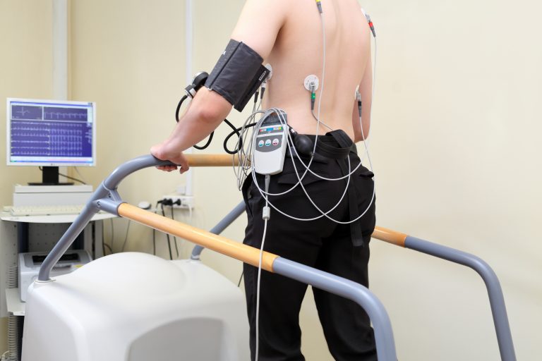 “What is the treadmill test procedure?”