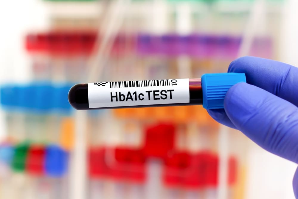 “Early detection of gestational diabetes through routine prenatal screening is vital.”