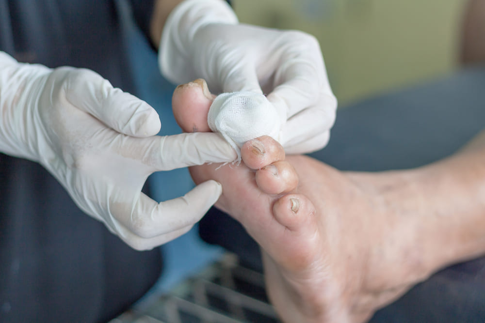 “How does diabetes affect wound healing and skin health? I’d like to understand…”